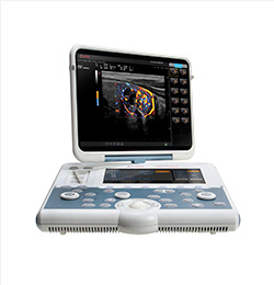 MyLab Gamma Laptop Ultrasound