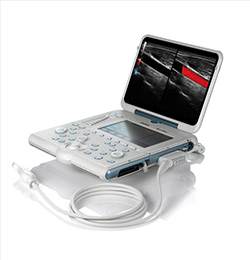 MyLab Alpha Laptop Ultrasound